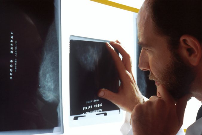 Radiologist looking at X-rays, Photo by National Cancer Institute on Unsplash