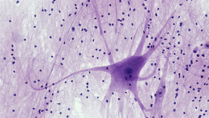 Nervous Tissue: Spinal Cord Motor Neuron. Photo by Bioscience Image Library by Fayette Reynolds.